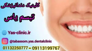 مرکز کلینیک دندانپزشکی تبسم یاس بابل مازندران