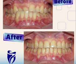 مرکز کلینیک دندانپزشکی فراز تبریز